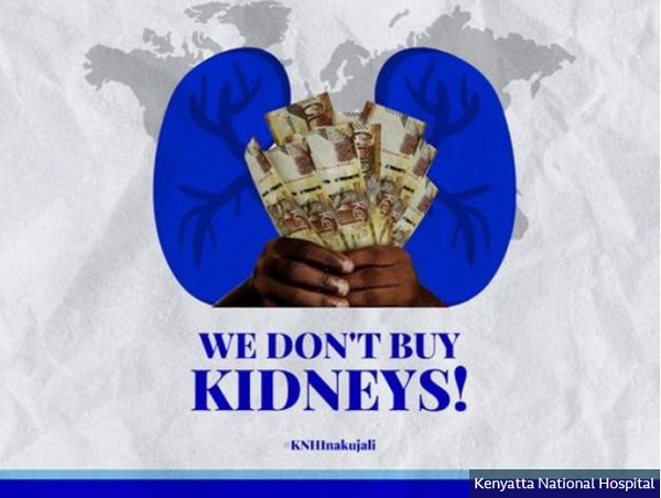 No, we don’t buy kidneys – Hospital