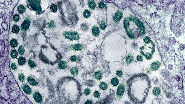 Marburg Virus Disease: Ghana confirms two cases