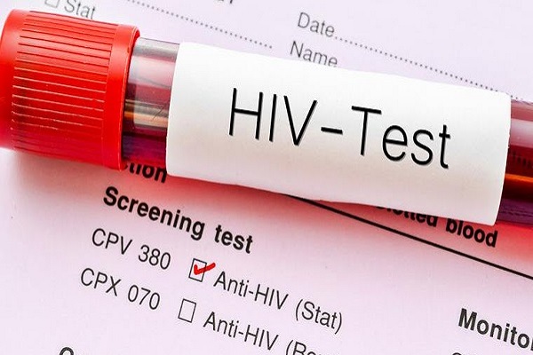 Over 23,000 people test positive for HIV in six months